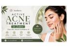Active Acne Treatment in Indore – Aestheva