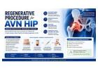 Regenerative Procedure for AVN Hip Treatment – SVF Therapy
