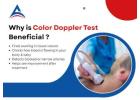 Why Colour Doppler Test Supports Better Blood Flow Check