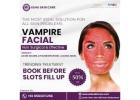 Reveal Radiant Skin with Vampire Facial at Ashu Skin Care!