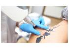 Best Tattoo Cream