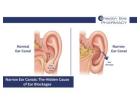 Narrow Ear Canals: The Hidden Cause of Ear Blockages