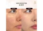 Best Skin Booster Treatment in KL for Glowing Skin