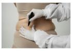 Lymphedema Therapy Nassau FL