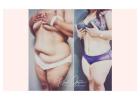 Tummy Tuck Surgery for Flat Belly That You Desire