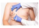 How to Get Gynecomastia Surgery Covered by Insurance?