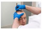 Dr Ditta Hair Transplants Creates Natural Results with Hair Implants in Manchester