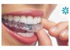 Teeth Whitening Service In Huntington Beach