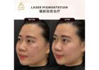 Skin Pigmentation Facial Treatment in KL | Advanced Laser Care at A Klinik