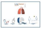 Top Specialists for Advanced Lung Cancer Treatment in Singapore