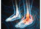 Peripheral Neuropathy Treatment Flint