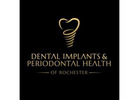 Dental Implants & Periodontal Health