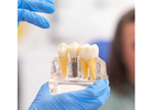 Find top-notch surgeons and dental equipment for Wisdom teeth removal Tijuana