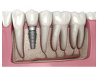 Trusted Dentist in Abbotsford | Your Local Dentist Near Me