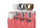 Dental Clinic in Madurai 