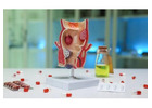 Dr. Kyriakos Neofytou: Hemorrhoids Treatment for Effective Relief and Better Comfort