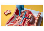 Reliable Kidney stone treatment in siliguri with Expert Urology Care