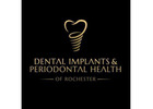 Dental Implants & Periodontal Health