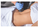 Body Contouring Tampa FL for a Sculpted, Defined Look