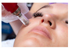 Microneedling Treatment Houston for Smoother, Radiant Skin