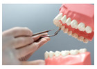 Missing Teeth? Discover Dental Bridges Arizona for a Restored Smile