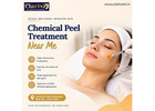 Chemical Peel Treatment Near Me – Shanthipura, Bangalore