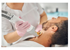Best Laser Hair Removal Houston for Smooth Skin