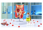 Hemorrhoids Treatment for Lasting Comfort and Better Care by Dr. Kyriakos Neofytou