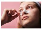 Laser Treatment For Acne Scars Orlando