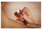 Bryant Park Acupuncture & Holistic Wellness in Midtown NYC - Grand Madison Acupuncture