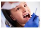 Expert Wisdom Teeth Removal Services Preston