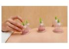 Cupping Therapy NYC | Expert Cupping Services in New York City