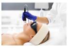 Fractionated CO2 Laser for Acne Scars & Pigmentation in Altamonte Springs, Orlando, Daytona Beach & 