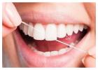 Best Smile Makeovers Preston Experts Available