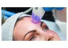 Advanced RF Microneedling in Raleigh for Skin Rejuvenation and Firming