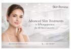 Skin Treatments In Whangaparaoa – Acne, Pigmentation & More