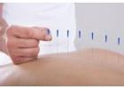 Best Acupuncture in Beverley Acres
