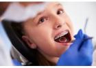 Expert Wisdom Teeth Removal Services Preston