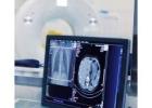 Top Medical Ultrasound Machine Supplier