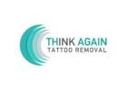 Think Again Tattoo Removal - Los Angeles
