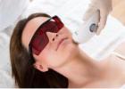 Fractionated CO2 Laser for Acne Scars & Pigmentation in Altamonte Springs, Orlando, Daytona Beach &
