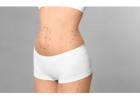 What Body Part is Most Painful to Liposuction?