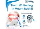 Teeth Whitening in Mount Roskill