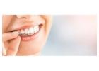 A Clear Guide to Invisible Braces Cost in Gurgaon