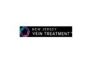 Vein Treatment New Jersey 
