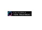 Vein Treatment California