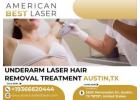 Underarm Laser Hair Removal Treatment Austin, Texas | Smooth, Pain-Free Skin