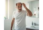 Restore Your Confidence with Expert Hair Transplants