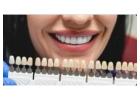 Get a Perfect Smile with the Veneers Teeth Process In