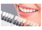 Porcelain Veneers with Durable and Natural Results